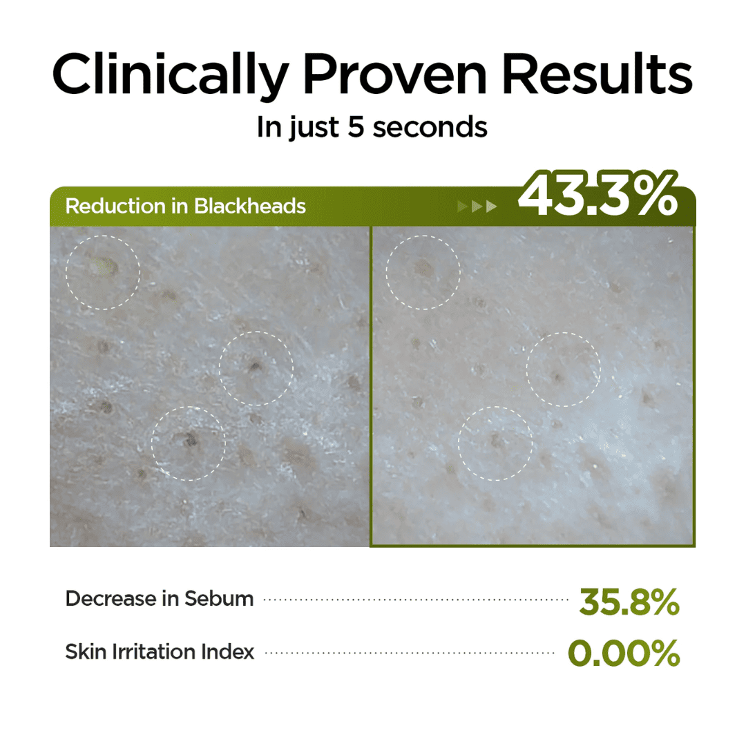 P.CALM Holy Basil Pore Cleansing Oil
