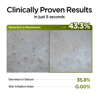 P.CALM Holy Basil Pore Cleansing Oil